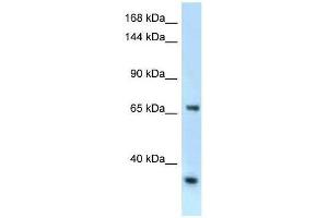Western Blot showing Rbm15b antibody used at a concentration of 1. (RBM15B anticorps  (C-Term))