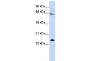 Image no. 1 for anti-Zinc Finger Protein 326 (ZNF326) (N-Term) antibody (ABIN6740648) (ZNF326 anticorps  (N-Term))