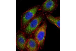 Immunofluorescence (IF) image for anti-Mitogen-Activated Protein Kinase 14 (MAPK14) antibody (ABIN2996778) (MAPK14 anticorps)