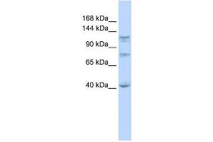 DHX30 antibody used at 1 ug/ml to detect target protein. (DHX30 anticorps)