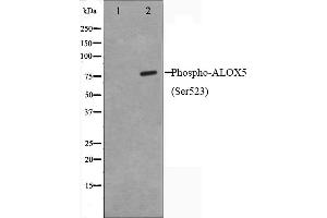 Western blot analysis on HuvEc cell lysate using Phospho-ALOX5(Ser523) Antibody,The lane on the left is treated with the antigen-specific peptide.