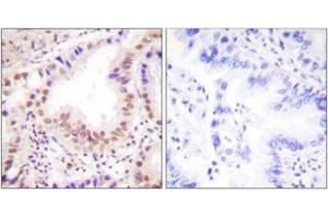 Immunohistochemistry (IHC) image for anti-V-Ets erythroblastosis Virus E26 Oncogene Homolog 1 (Avian) (ETS1) (AA 11-60) antibody (ABIN2888658) (ETS1 anticorps  (AA 11-60))