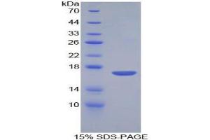 SDS-PAGE analysis of Mouse Corin Protein. (Corin Protéine)