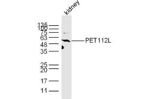 Mouse kidney lysates probed with PET112L Polyclonal Antibody, unconjugated  at 1:300 overnight at 4°C followed by a conjugated secondary antibody at 1:10000 for 60 minutes at 37°C. (PET112L anticorps  (AA 101-200))