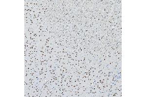 IHC analysis of SNRNP200 using anti-SNRNP200 antibody (ABIN7602032).