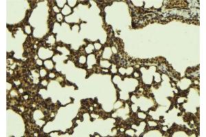 ABIN6276784 at 1/100 staining Mouse lung tissue by IHC-P. (ETV6 anticorps  (Internal Region))