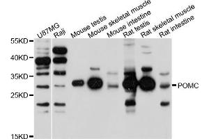 Western blot analysis of extracts of various cell lines, using POMC antibody (ABIN5971555) at 1/1000 dilution. (ACTH anticorps)