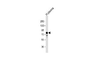 Anti-VTN Antibody (N-term) at 1:32000 dilution + human plasma lysate Lysates/proteins at 20 μg per lane. (Vitronectin anticorps  (N-Term))