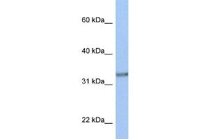 Human MCF-7; WB Suggested Anti-ACBD4 Antibody Titration: 0. (ACBD4 anticorps  (N-Term))
