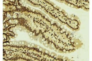 ABIN6277787 at 1/100 staining Mouse colon tissue by IHC-P. (SMARCA4 anticorps  (N-Term))