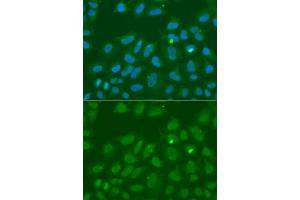 Immunofluorescence analysis of A549 cells using ORC6 antibody (ABIN5973151). (ORC6 anticorps)