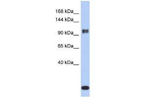 WB Suggested Anti-ATXN7 Antibody Titration: 0. (ATXN7 anticorps  (Middle Region))