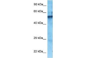 Host:  Rabbit  Target Name:  ZNF25  Sample Type:  Fetal Lung lysates  Antibody Dilution:  1. (ZNF25 anticorps  (N-Term))