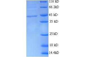 SDS-PAGE (SDS) image for Receptor Tyrosine Kinase-Like Orphan Receptor 1 (ROR1) (AA 30-391), (Extracellular) protein (His tag) (ABIN5710268)