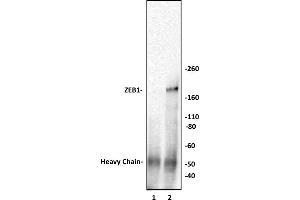 ZEB1 antibody (pAb) tested by Immunoprecipitation.