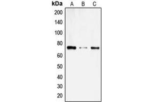 Western blot analysis of SLC6A14 expression in SKNMC (A), COLO205 (B), HL60 (C) whole cell lysates. (Slc6a14 anticorps  (C-Term))