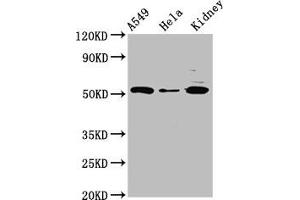 Western Blot Positive WB detected in: A549 whole cell lysate, Hela whole cell lysate, Rat kidney tissue All lanes: FICD antibody at 3 μg/mL Secondary Goat polyclonal to rabbit IgG at 1/50000 dilution Predicted band size: 52 kDa Observed band size: 52 kDa (FICD anticorps  (AA 63-185))