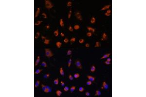 Immunofluorescence analysis of L929 cells using TMEM25 antibody (ABIN7270963) at dilution of 1:100. (TMEM25 anticorps  (AA 223-322))