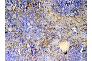 IHC analysis of ICOS using anti-ICOS antibody . (ICOS anticorps  (AA 21-200))