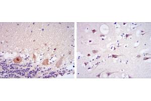 Immunohistochemical analysis of paraffin-embedded cerebellum tissues (left) and brain tissues (right) using CDK5 mouse mAb with DAB staining.