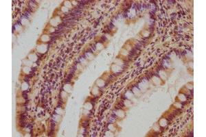 IHC image of ABIN7162407 diluted at 1:100 and staining in paraffin-embedded human small intestine tissue performed on a Leica BondTM system.