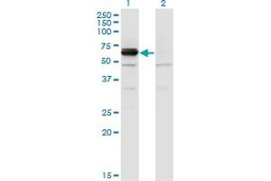 Western Blot analysis of DPYSL4 expression in transfected 293T cell line by DPYSL4 monoclonal antibody (M01), clone 1F5. (DPYSL4 anticorps  (AA 461-559))