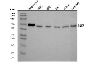 Western blot analysis of PAK3 using anti-PAK3 antibody (ABIN7599182).