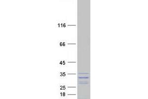 Validation with Western Blot
