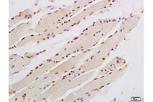 Formalin-fixed and paraffin embedded human smooth muscle labeled with Anti-KLF6/PAC1 Polyclonal Antibody, Unconjugated (ABIN685927) at 1:200 followed by conjugation to the secondary antibody and DAB staining. (KLF6 anticorps)