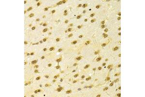 Immunohistochemistry of paraffin-embedded rat brain using HDGF Antibody (ABIN1876535) at dilution of 1:100 (40x lens). (HDGF anticorps)