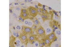 Immunohistochemistry of paraffin-embedded Human liver, using NBR1 Polyclonal Antibody (NBR1 anticorps)