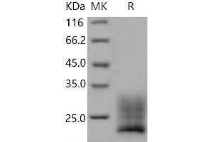 Western Blotting (WB) image for Regenerating Islet-Derived Family, Member 4 (REG4) (Active) protein (His tag) (ABIN7320368)