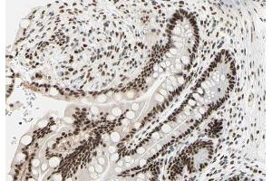 ABIN6266854 at 1/100 staining human colon tissue sections by IHC-P. (PRKDC anticorps  (Internal Region))