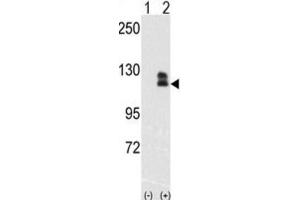Western Blotting (WB) image for anti-EPH Receptor B2 (EPHB2) antibody (ABIN3003348) (EPH Receptor B2 anticorps)