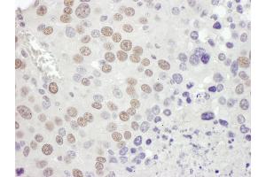 Immunohistochemistry (IHC) image for anti-Mismatch Repair Protein 2 (MSH2) (C-Term) antibody (ABIN7453440) (MSH2 anticorps  (C-Term))