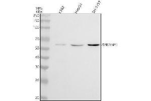 Western blot analysis of PEDF using anti-PEDF antibody (ABIN7605905).