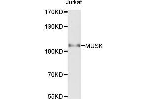 Western blot analysis of extracts of Jurkat cells，using MUSK antibody. (MUSK anticorps)