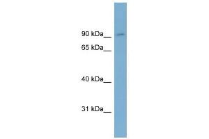 OSBPL1A antibody used at 1 ug/ml to detect target protein. (OSBPL1A anticorps  (Middle Region))