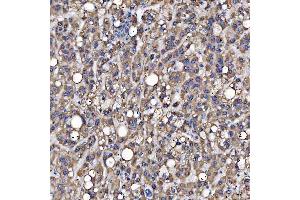 IHC analysis of SARS2 using anti-SARS2 antibody (ABIN7601804). (SARS2 anticorps  (AA 46-518))