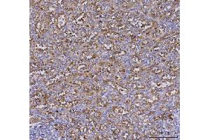 IHC analysis of TLR9 using anti-TLR9 antibody (ABIN7602935).