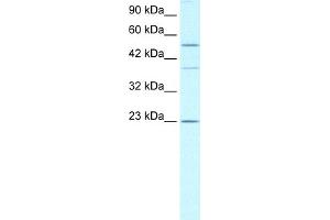 WB Suggested Anti-ZNFN1A1 Antibody Titration:  0. (IKZF1 anticorps  (Middle Region))