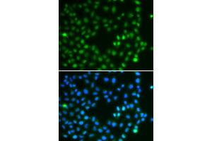 Immunofluorescence analysis of A549 cells using SALL4 antibody (ABIN6132627).