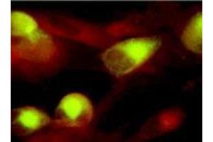 Immunofluorescence (IF) image for anti-CMV gB antibody (ABIN265541) (CMV gB anticorps)
