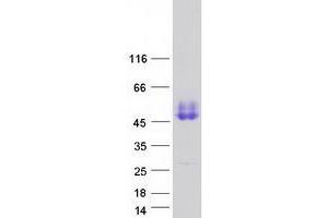 Validation with Western Blot