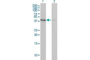 Western Blotting (WB) image for anti-Actin, beta (ACTB) (AA 1-376) antibody (ABIN598523) (beta Actin anticorps  (AA 1-376))