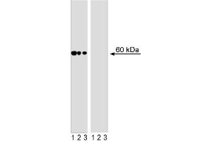 Western blot analysis of AKT (pS473) in human T leukemia. (AKT1 anticorps  (pSer473))