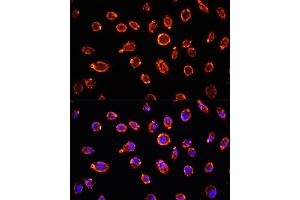 Immunofluorescence analysis of L929 cells using BNP Rabbit pAb (ABIN3023135, ABIN3023136, ABIN3023137, ABIN1513273 and ABIN6219406) at dilution of 1:100.