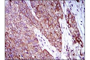 Immunohistochemistry (IHC) image for anti-Zinc Finger Protein 42 (ZFP42) (AA 249-310) antibody (ABIN1846770) (ZFP42 anticorps  (AA 249-310))