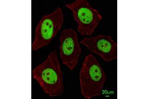 Immunofluorescent analysis of A549 cells, using LIN28A Antibody (Center) (ABIN655156 and ABIN2844774).