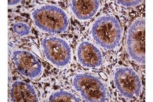 Image no. 4 for anti-Mucin 1 (MUC1) antibody (ABIN1499598)